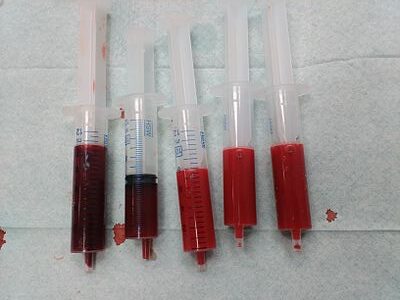 Blood with low blood oxygen level